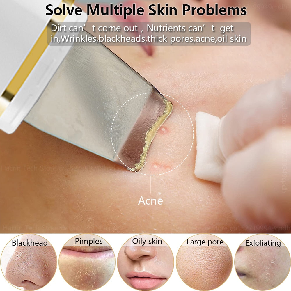 Skin Scrubber Ultrasonic Peeling Facial Scrubber